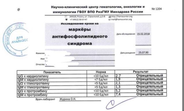 АФС