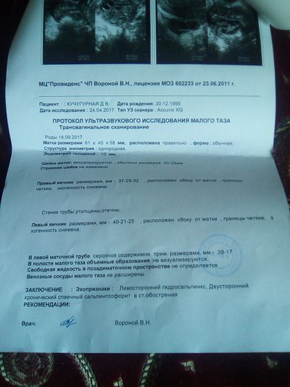 Мда сходила на УЗИ!!