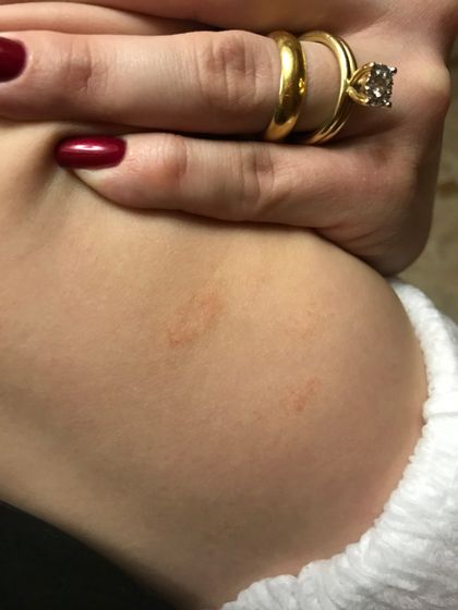 Что это за пятна???♀️