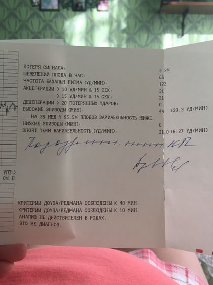Подозрительный тип КТГ