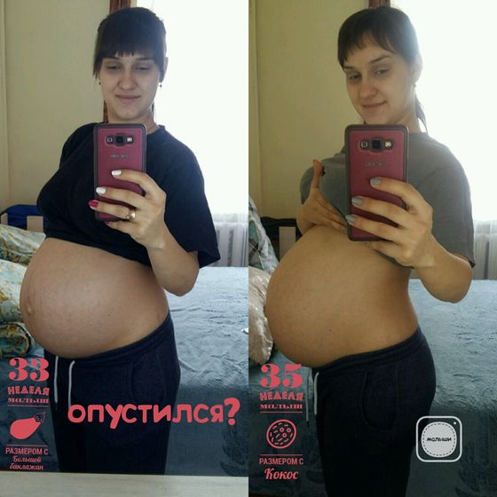 Нам 35 неделек...ровно 🤗🤗🤗