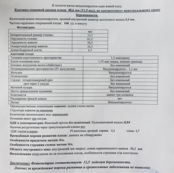 УРА! Первое знакомство с малышом