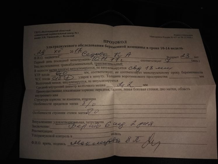 Бьётся сердечко))