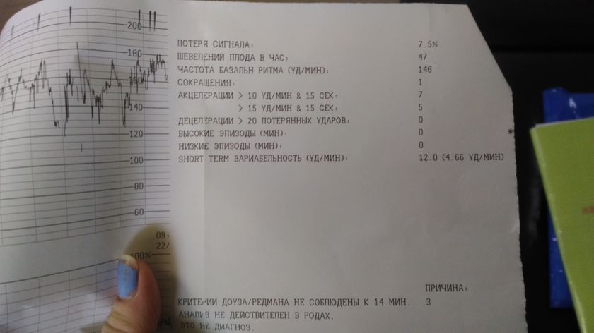 Ктг