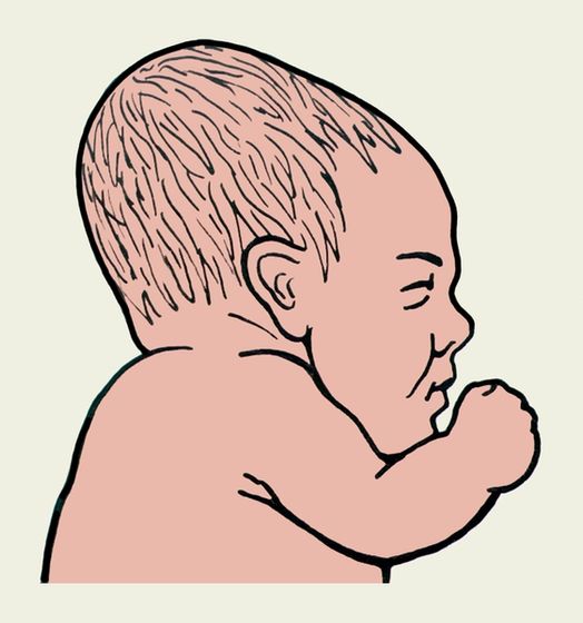 Вытянутая голова🚼