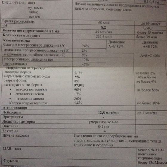 СГ