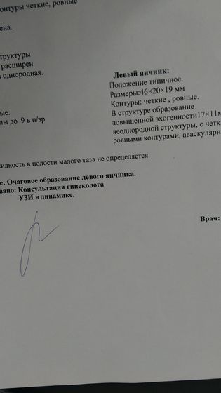 Ну здрасте, сходила на узи