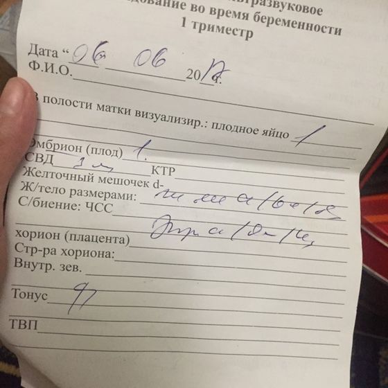 У МЕНЯ ИСТЕРИКА, СХОДИЛА НА УЗИ