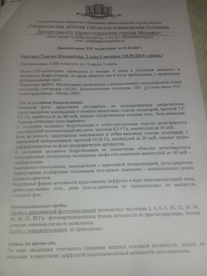 Результаты Ээг дневного сна и эпилепсия