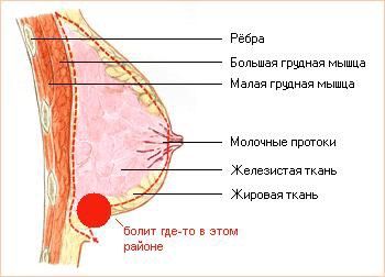 Застудила грудь