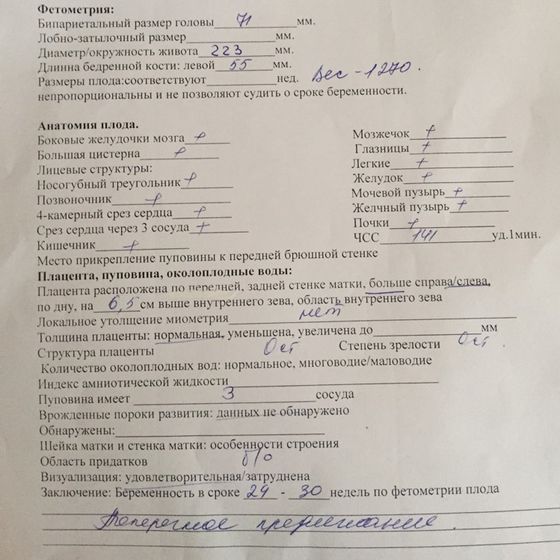 УЗИ 29-30 недели