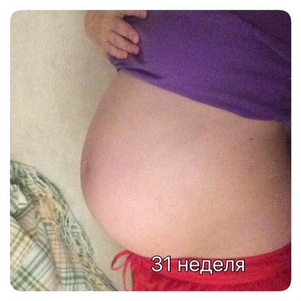 31 неделя