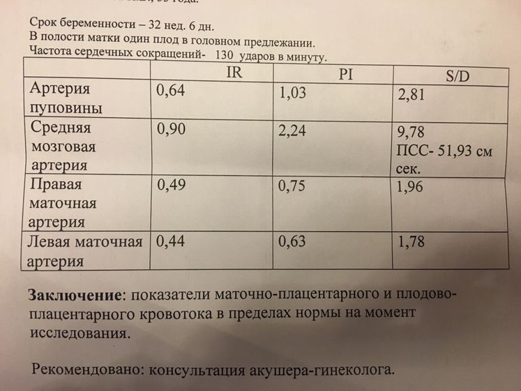 Допплер?