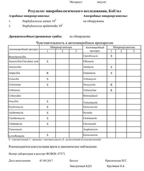 Обнаружили у мужа ,