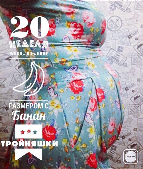 20 недель. Тройня. Экватор.
