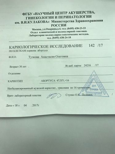 47 XY трисомия по 16 хромосоме