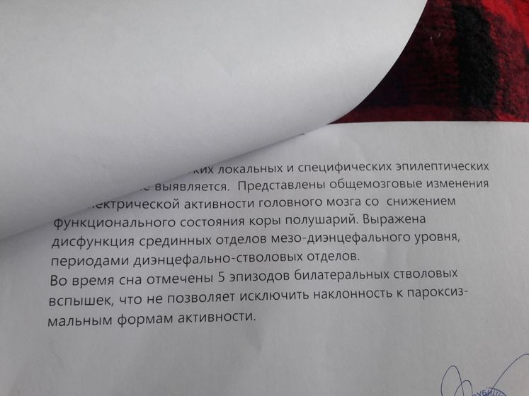 Ээг расшифровка