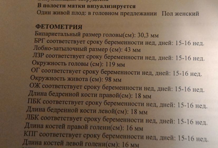 УЗИ и счастье!!!!:-)