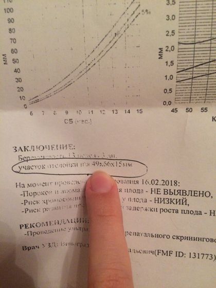 Гематома