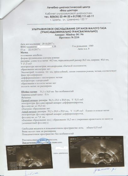 Кто понимает в фолликулометрии?