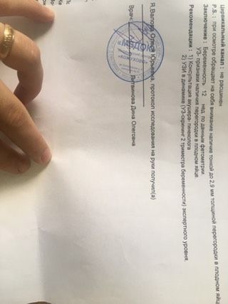 Перегородке в плодном яйце 1 плод точно