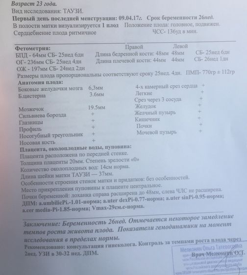 Узи