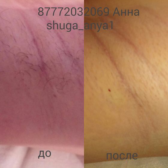 Шугаринг в алматы