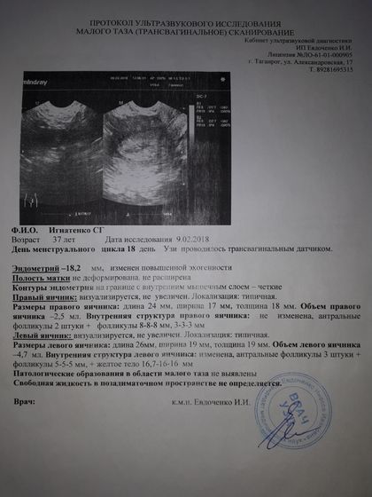 История одного циклала🙄