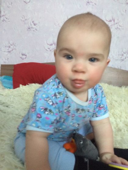 Аллергия на холод