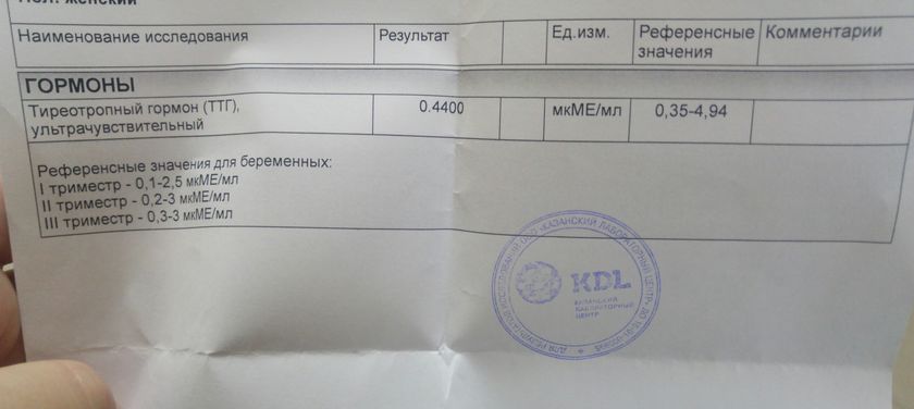 ТТГ