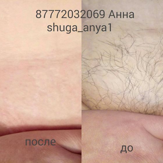 Шугаринг в алматы