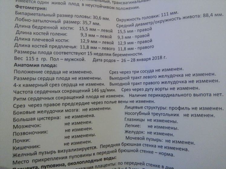 Сходила на Узи, сказали