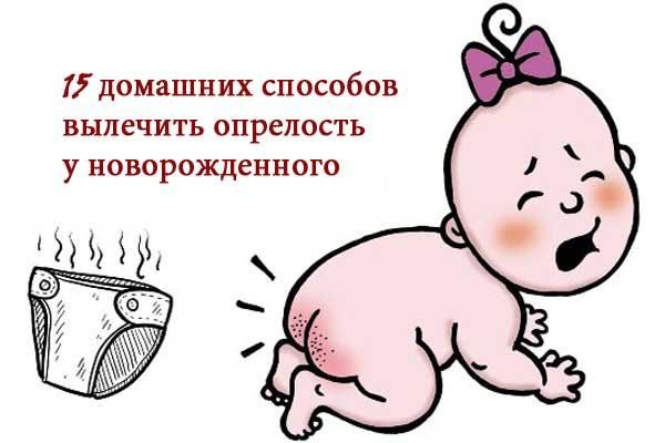Как вылечить опрелость