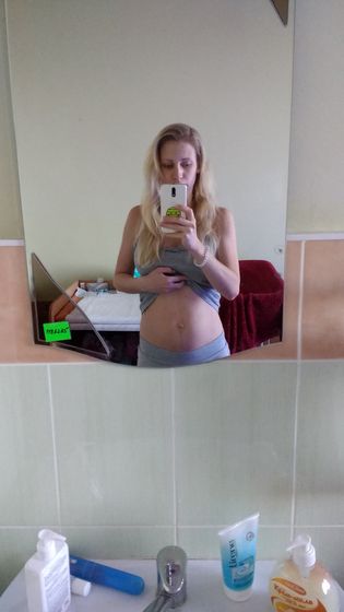 Животик на 3и сутки после ВТОРЫХ родов?? ФОТО