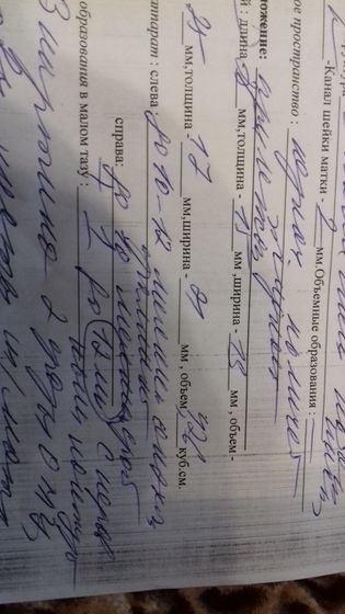 Фото моего узи
