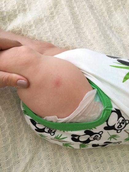 Прививка и реакция на нее
