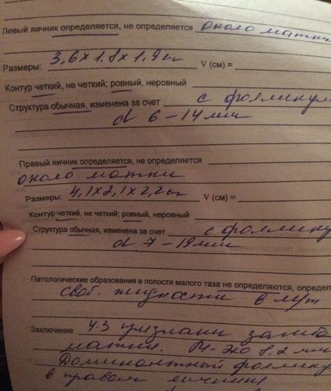 Не могу понять когда