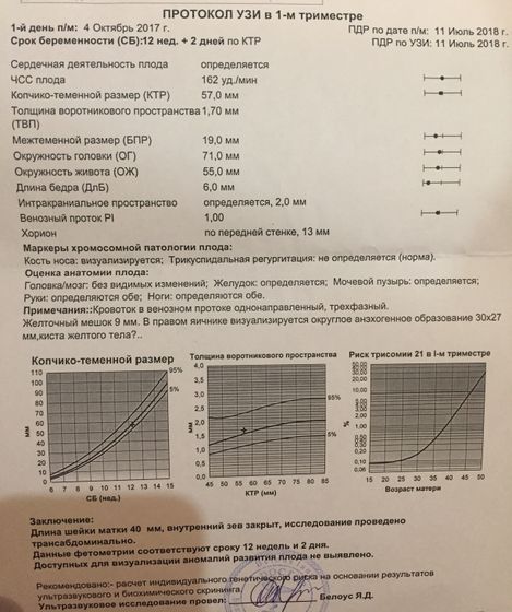 Мой первый скрининг!!!