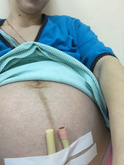 Мои вторые Роды ????