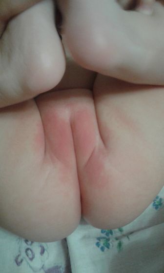 У дочки писюха покраснела ((Интим фото?