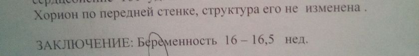 Что это значит ????