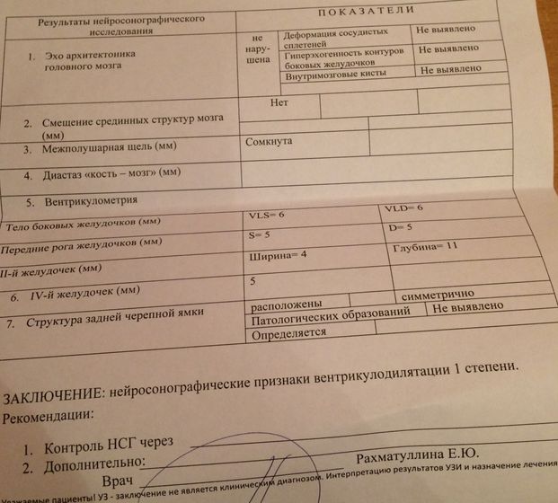 Расширение боковых желудочков.