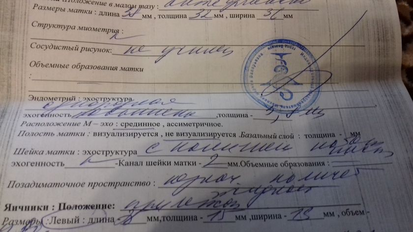 Фото моего узи