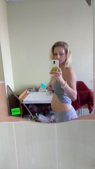 Животик на 3и сутки после ВТОРЫХ родов?? ФОТО