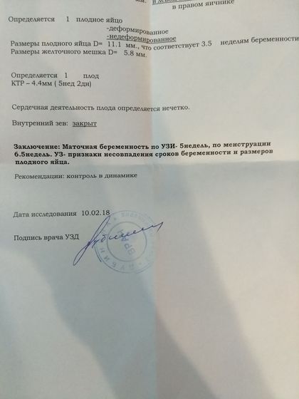 Сердечная деятельность определяется нечетко