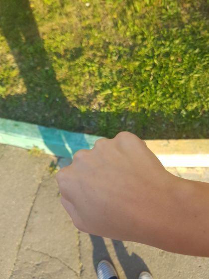 Я опять про вены
