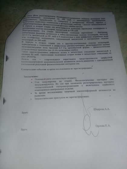 Результаты Ээг дневного сна и эпилепсия