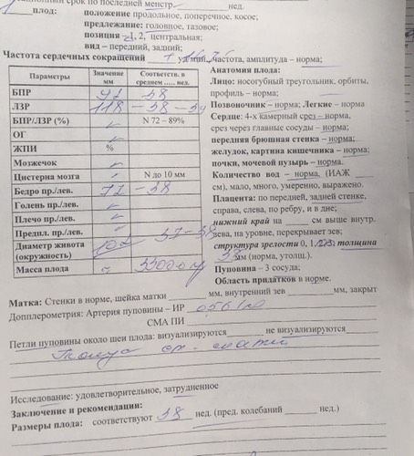Узи в 36,6