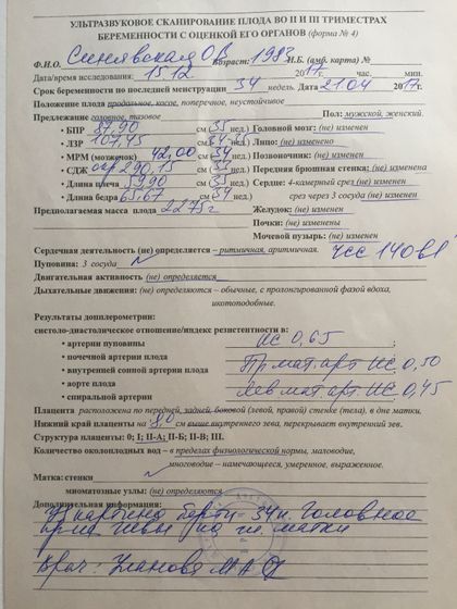 Наши 34 недели.