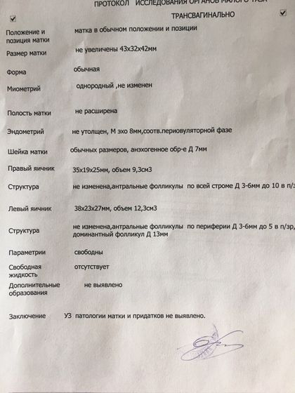 ДФ 13 мм на 17 ДЦ